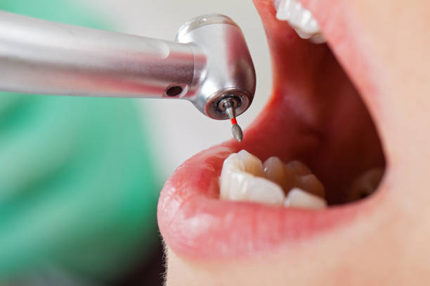 Best Urgent Dental Care for Toothaches in Markham, IL